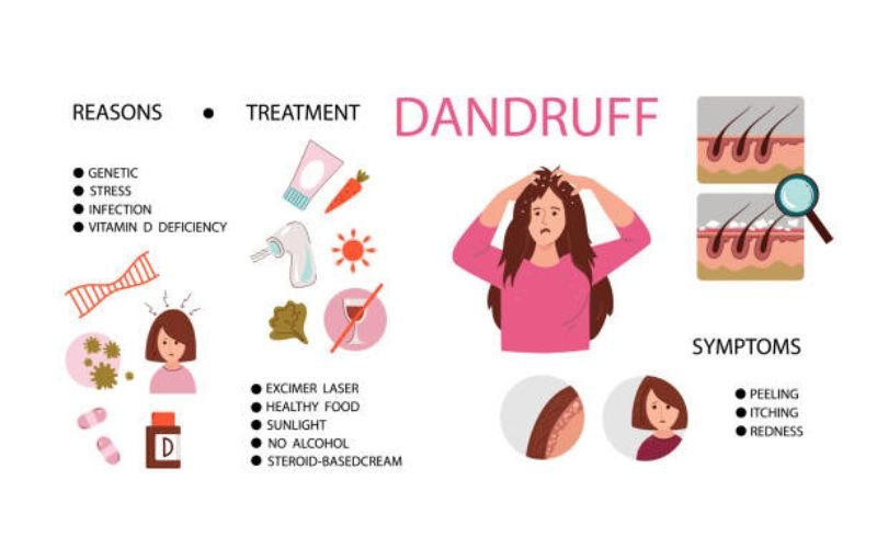 Causes of itchy scalp and hair loss infographic