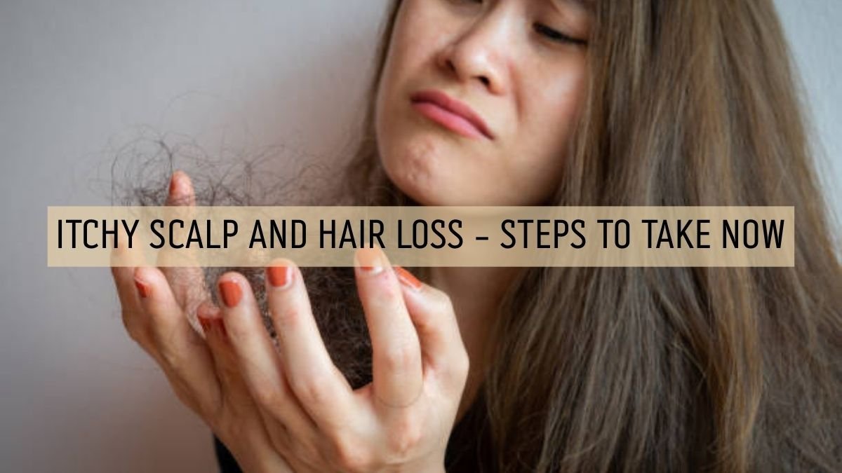 Woman holding fallen hair strands due to itchy scalp and hair loss.