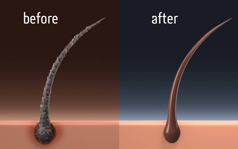  Before and after results of using shampoo for itchy scalp and hair loss