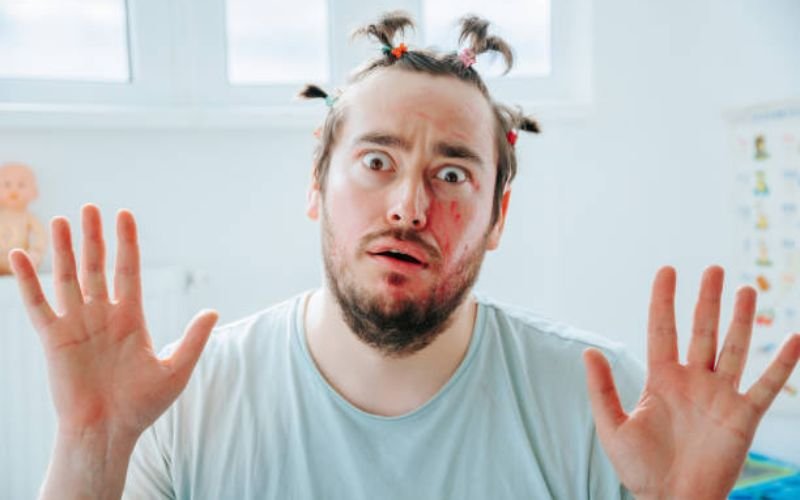 Man showing red irritated scalp from shaving mistakes.