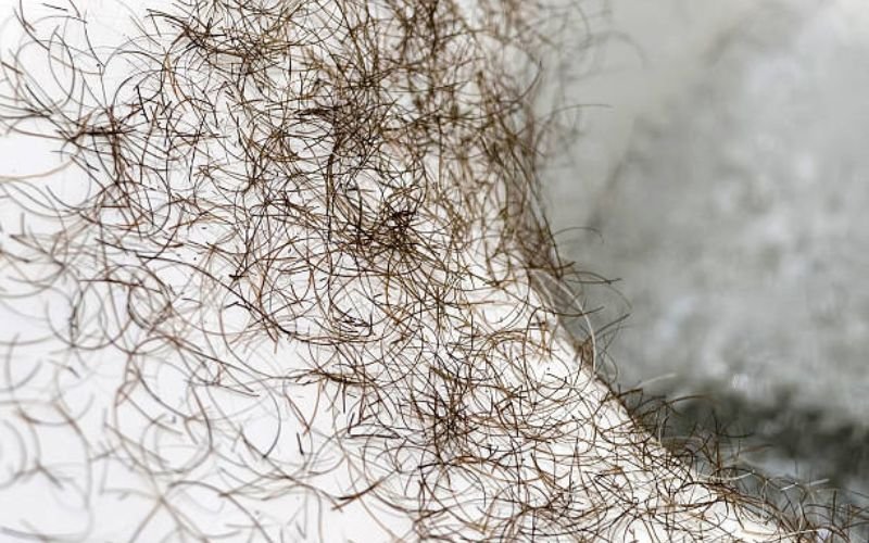 Close-up of dry scalp in winter causing hair fall