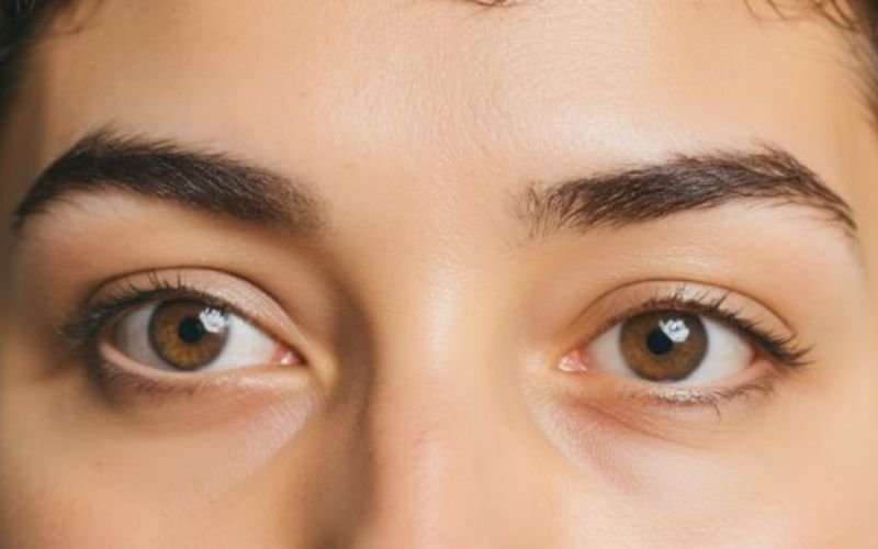 Comparison of healthy eyebrows versus thinning eyebrows in women