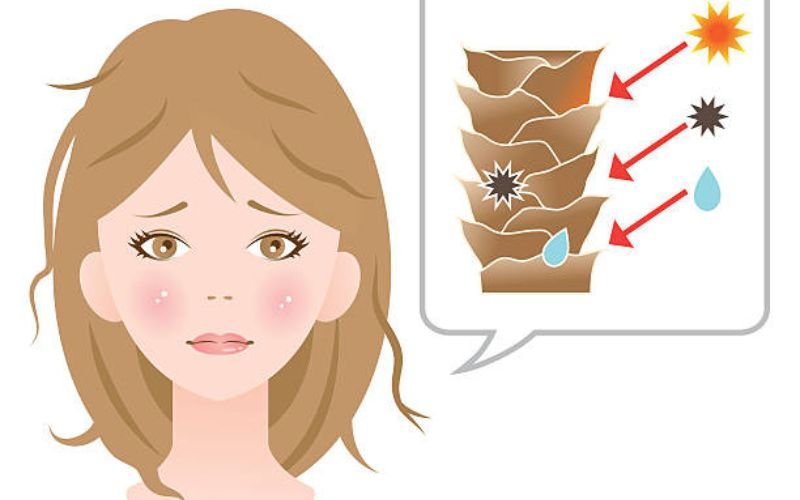 Main causes of dry scalp and seborrheic dermatitis including skin dryness and excess oil