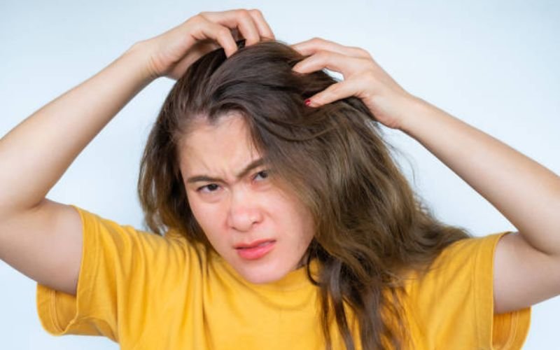 Common symptoms of dry scalp and seborrheic dermatitis including itching redness and flakes