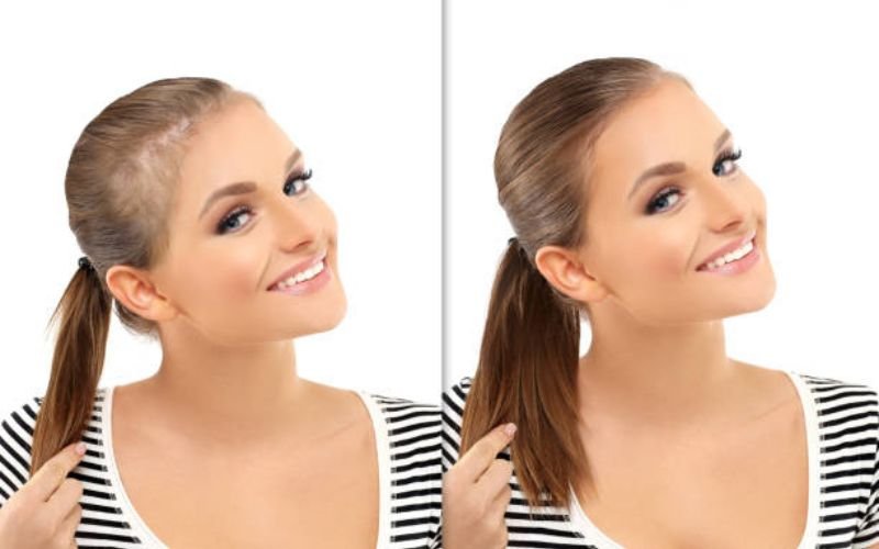 rosemary oil before and after hair growth results comparison